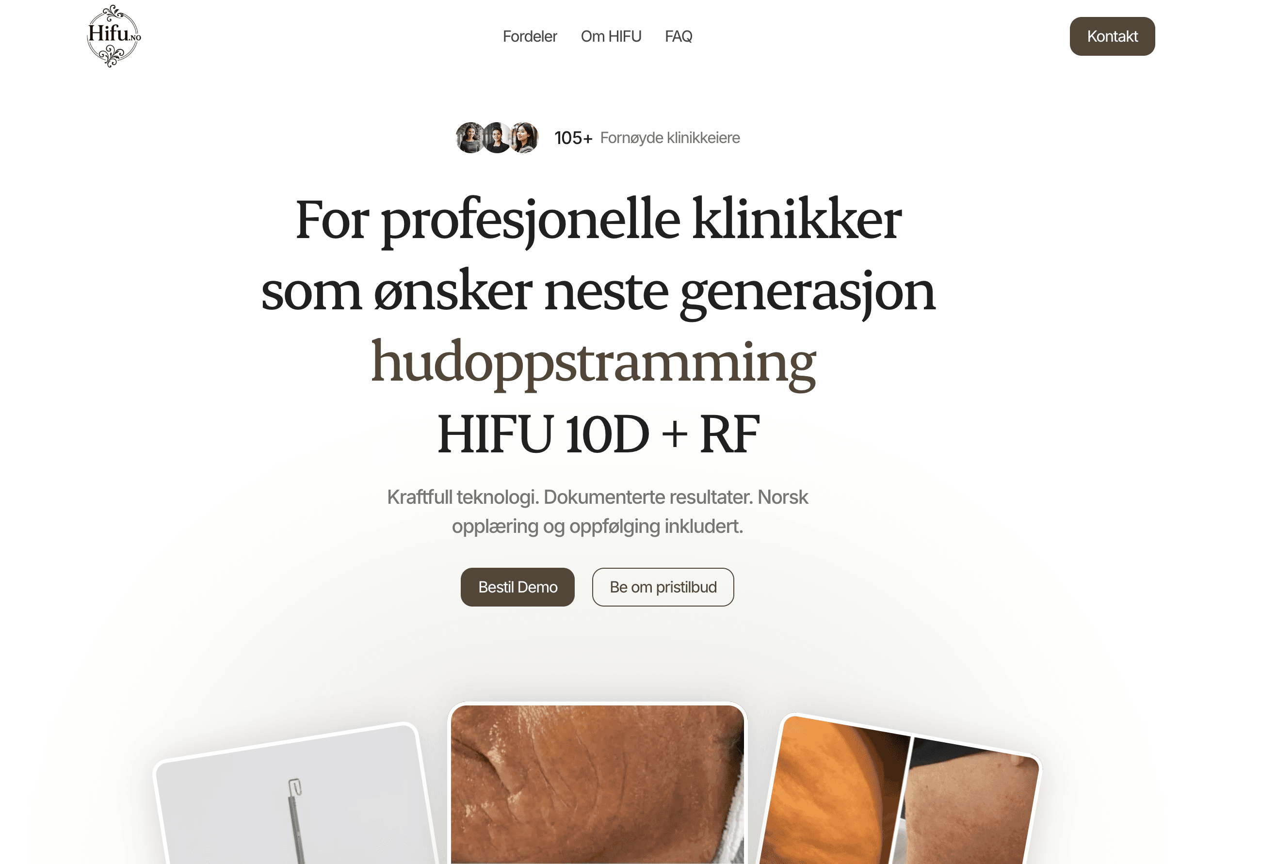 HIFU 10D + RF Norge | Hudoppstramming uten kirurgi – Hifu